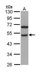 Anti-RCC1 antibody [N1C1] used in Western Blot (WB). GTX113402