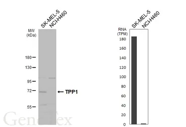 Anti-TPP1 antibody [N1C1] used in Western Blot (WB). GTX113404