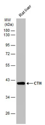 Anti-CTH antibody used in Western Blot (WB). GTX113409