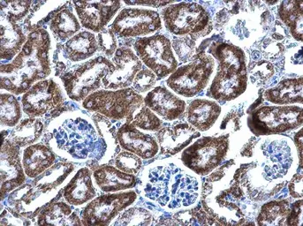 Anti-DBT antibody used in IHC (Paraffin sections) (IHC-P). GTX113412