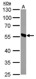 Anti-DBT antibody used in Western Blot (WB). GTX113412