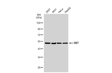Anti-DBT antibody used in Western Blot (WB). GTX113412