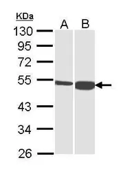Anti-DBT antibody used in Western Blot (WB). GTX113412