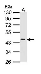 Anti-ICAD antibody [N2C3] used in Western Blot (WB). GTX113416
