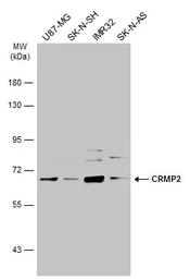 Anti-CRMP2 antibody [N1N3] used in Western Blot (WB). GTX113420
