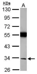 Anti-TorsinA antibody [N1C2] used in Western Blot (WB). GTX113421