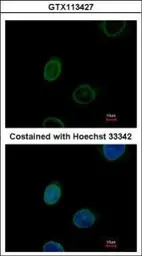 Anti-Emerin antibody used in Immunocytochemistry/ Immunofluorescence (ICC/IF). GTX113427