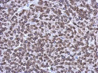 Anti-Emerin antibody used in IHC (Paraffin sections) (IHC-P). GTX113427