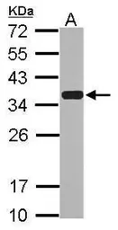 Anti-Emerin antibody used in Western Blot (WB). GTX113427