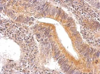 Anti-ENO3 antibody used in IHC (Paraffin sections) (IHC-P). GTX113429