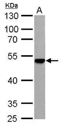 Anti-ENO3 antibody used in Western Blot (WB). GTX113429