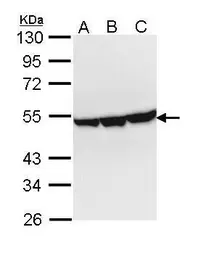 Anti-ENO3 antibody used in Western Blot (WB). GTX113429