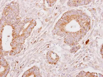 Anti-Fibrinogen gamma antibody used in IHC (Paraffin sections) (IHC-P). GTX113436