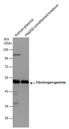 Anti-Fibrinogen gamma antibody used in Western Blot (WB). GTX113436
