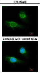 Anti-Fibrinogen gamma antibody used in Immunocytochemistry/ Immunofluorescence (ICC/IF). GTX113436
