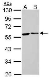 Anti-FKBP4 antibody used in Western Blot (WB). GTX113437