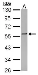 Anti-FKBP4 antibody used in Western Blot (WB). GTX113437