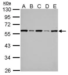 Anti-FKBP4 antibody used in Western Blot (WB). GTX113437