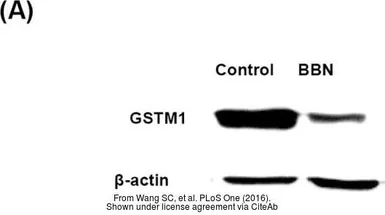Anti-GSTM1 antibody used in Western Blot (WB). GTX113448