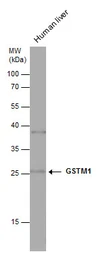 Anti-GSTM1 antibody used in Western Blot (WB). GTX113448