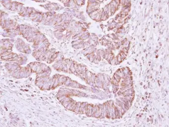 Anti-ERAB antibody [N1C3] used in IHC (Paraffin sections) (IHC-P). GTX113454