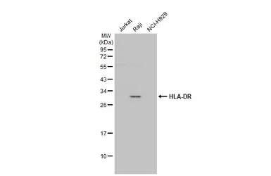 Anti-HLA-DR antibody [N2C3] used in Western Blot (WB). GTX113459