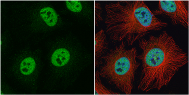 Anti-hnRNP C1/C2 antibody used in Immunocytochemistry/ Immunofluorescence (ICC/IF). GTX113463