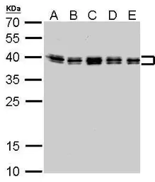 Anti-hnRNP C1/C2 antibody used in Western Blot (WB). GTX113463
