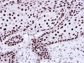 Anti-hnRNP C1/C2 antibody used in IHC (Paraffin sections) (IHC-P). GTX113463