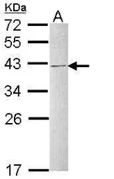 Anti-hnRNP C1/C2 antibody used in Western Blot (WB). GTX113463