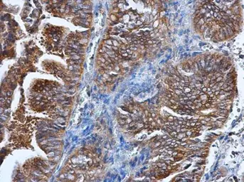 Anti-HPRT antibody used in IHC (Paraffin sections) (IHC-P). GTX113466