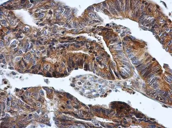 Anti-HPRT antibody used in IHC (Paraffin sections) (IHC-P). GTX113466