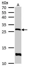 Anti-HPRT antibody used in Western Blot (WB). GTX113466