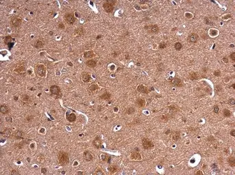 Anti-HPRT antibody used in IHC (Paraffin sections) (IHC-P). GTX113466