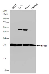 Anti-HPRT antibody used in Western Blot (WB). GTX113466