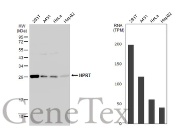 Anti-HPRT antibody used in Western Blot (WB). GTX113466