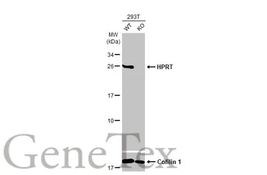 Anti-HPRT antibody used in Western Blot (WB). GTX113466