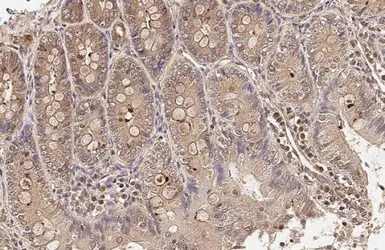 Anti-HPRT antibody used in IHC (Paraffin sections) (IHC-P). GTX113466