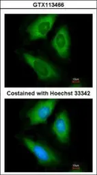 Anti-HPRT antibody used in Immunocytochemistry/ Immunofluorescence (ICC/IF). GTX113466