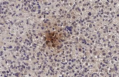 Anti-IGFBP2 antibody used in IHC (Paraffin sections) (IHC-P). GTX113471