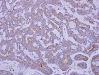 Anti-IGFBP2 antibody used in IHC (Paraffin sections) (IHC-P). GTX113471