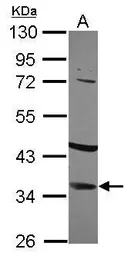 Anti-IGFBP2 antibody used in Western Blot (WB). GTX113471