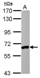 Anti-IRF5 antibody [N1C1] used in Western Blot (WB). GTX113477