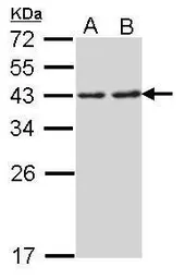 Anti-RPSA antibody [N2C3] used in Western Blot (WB). GTX113485