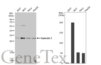 Anti-Galectin 3 antibody used in Western Blot (WB). GTX113486