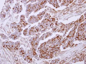 Anti-Lactoferrin antibody used in IHC (Paraffin sections) (IHC-P). GTX113488