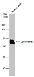Anti-Lactoferrin antibody used in Western Blot (WB). GTX113488