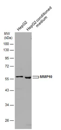 Anti-MMP10 antibody [N1C1] used in Western Blot (WB). GTX113496