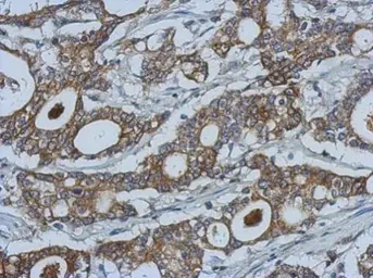Anti-MMP10 antibody [N1C1] used in IHC (Paraffin sections) (IHC-P). GTX113496