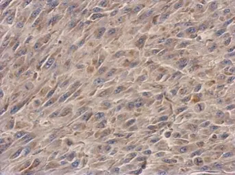 Anti-NDUFS3 antibody used in IHC (Paraffin sections) (IHC-P). GTX113504
